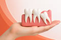 Hand holding a dental model showing an impacted wisdom tooth next to healthy molars.