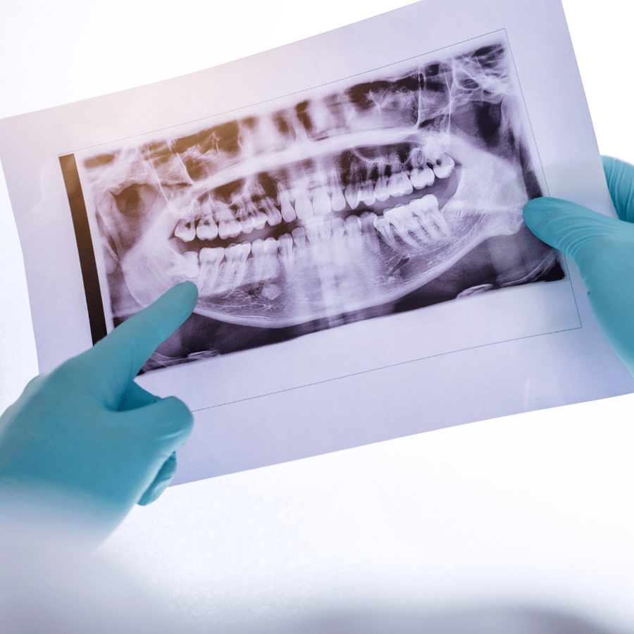 doctors hands pointing at jaw bone x-ray