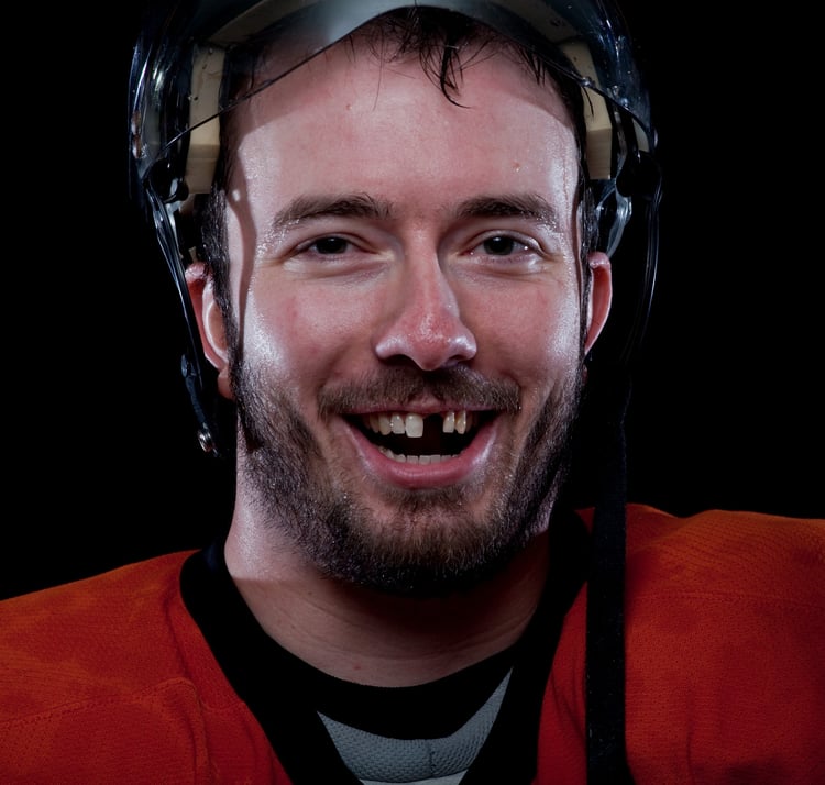 What to Do When an Adult Tooth Falls Out